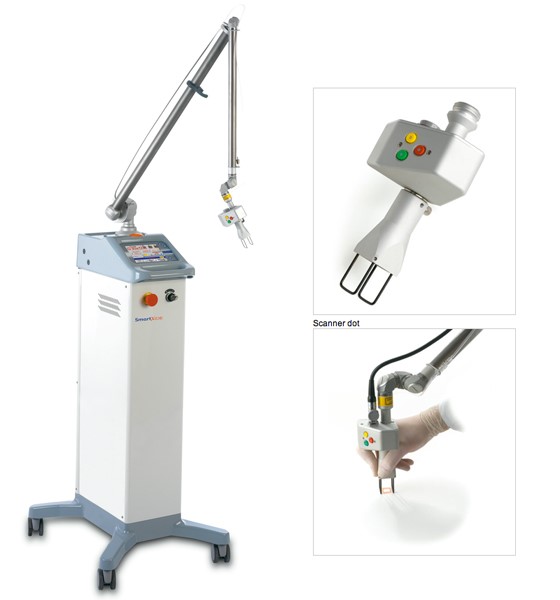 smartxide-equipment.jpg